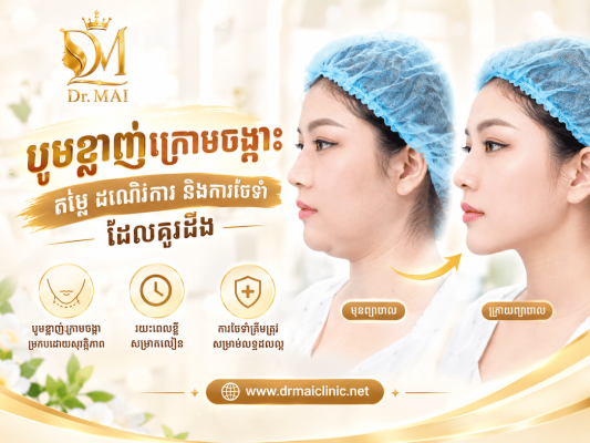 បូមខ្លាញ់ក្រោមចង្កា៖ តម្លៃ ដំណើរការ និងការថែទាំដែលគួរដឹង